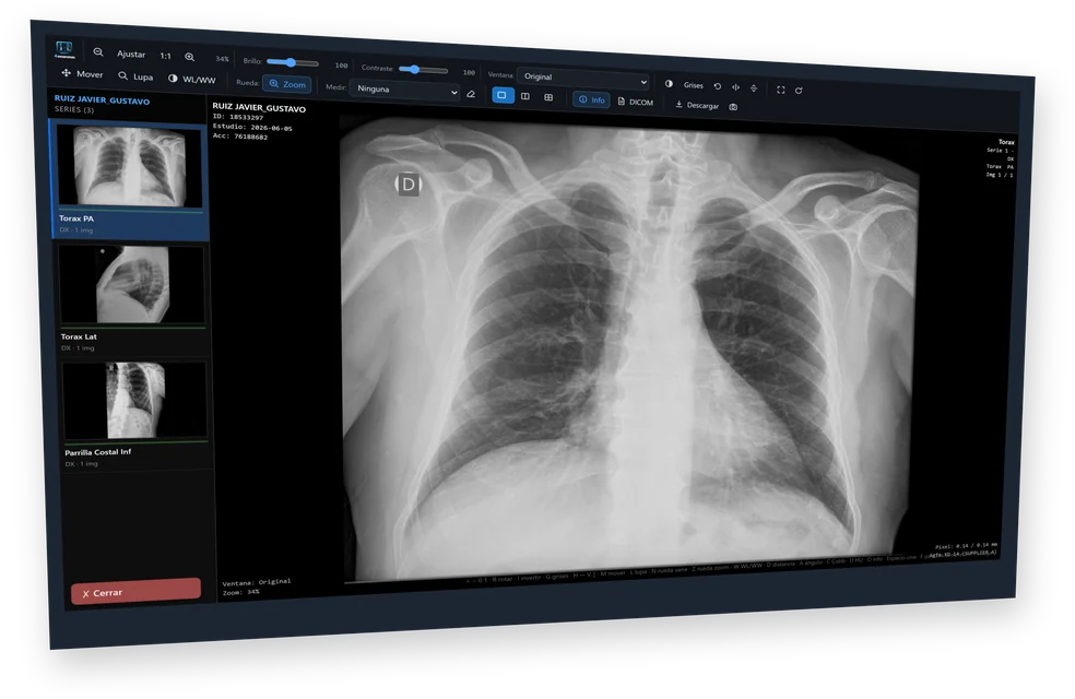 Visualizador web de 4Neuronas mostrando una radiografía de tórax con sus series